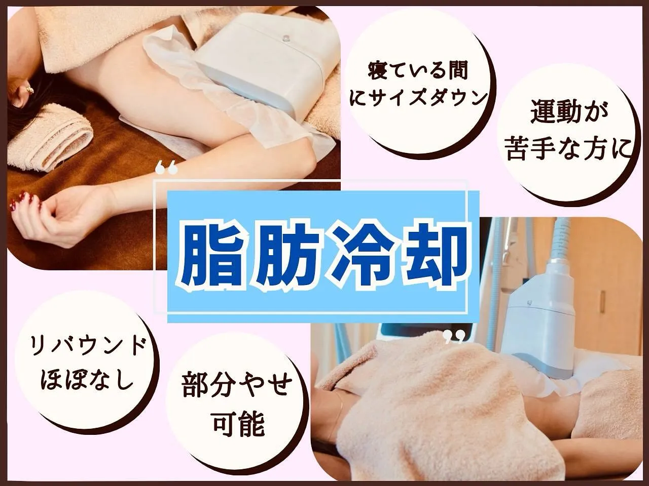 🧊 脂肪冷却を選ぶ【3つのメリット】